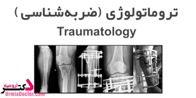 فوق تخصص تروماتولوژی در ارومیه