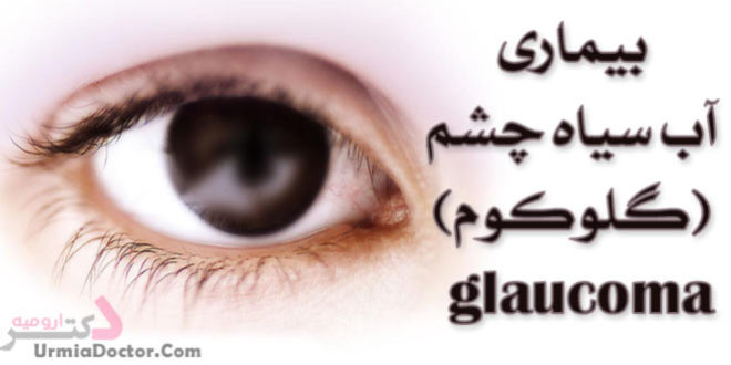بیماری آب سیاه چشم glaucoma