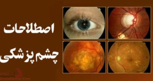 اصطلاحات چشم پزشکی