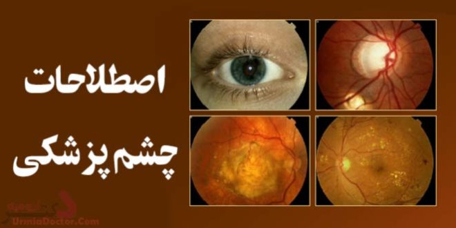اصطلاحات چشم پزشکی
