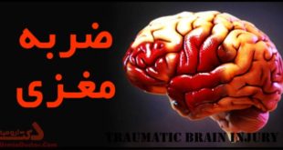 ضربه مغزی Traumatic brain injury