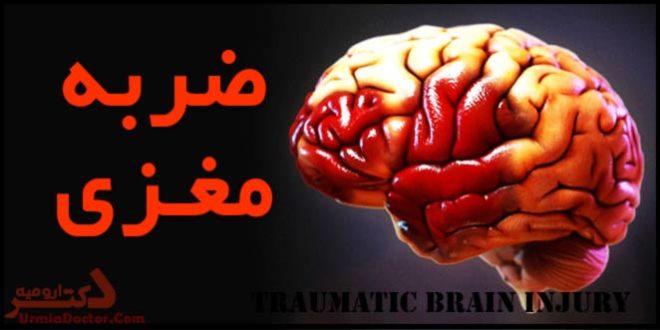 ضربه مغزی Traumatic brain injury
