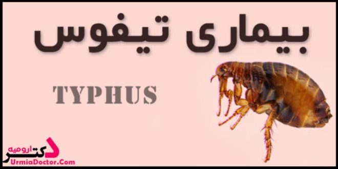 بیماری تیفوس Typhus disease