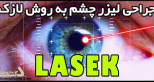 جراحی لیزر چشم به روش لازک LASEK