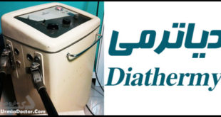 Diathermy دیاترمی چیست