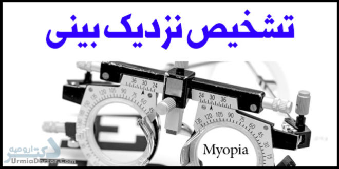 تشخیص نزدیک بینی یا میوپی Myopia