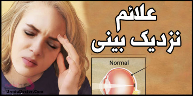 علائم نزدیک بینی myopia signs