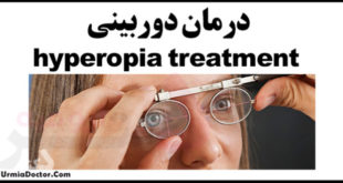 درمان دوربینی hyperopia treatment