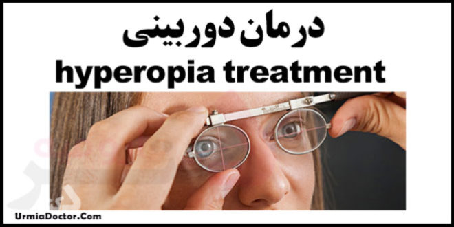 درمان دوربینی hyperopia treatment