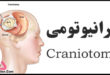 جراحی کرانیوتومی Craniotomy