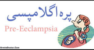 پره اگلامپسی Pre Eclampsia
