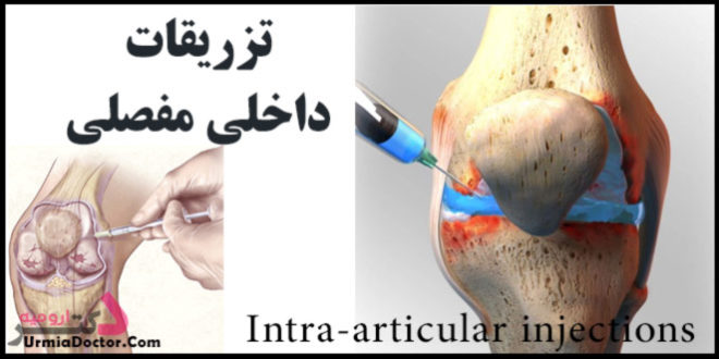 تزریقات داخل مفصلی Intra-articular injections