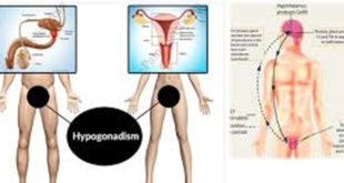 هیپوگنادیسم یا کاهش فعالیت بیضه در مردان