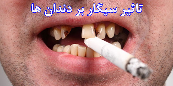 تاثیر سیگار بر دندان ها