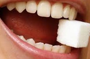 تاثیر بیماری قند بر روی دندان ها