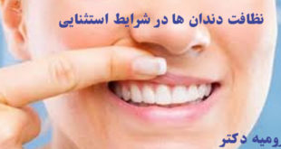 نظافت دندان ها در شرایط استثنایی