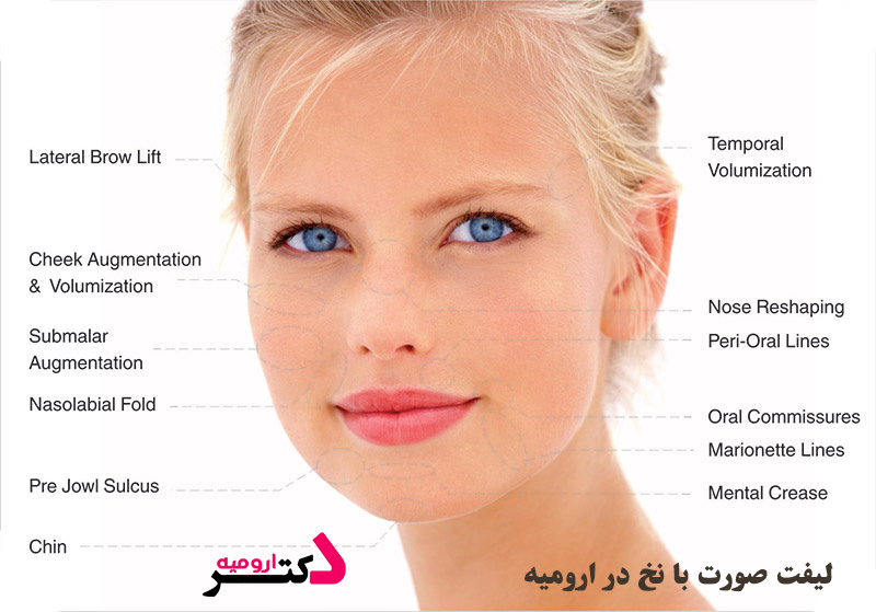 لیفت نخ در ارومیه