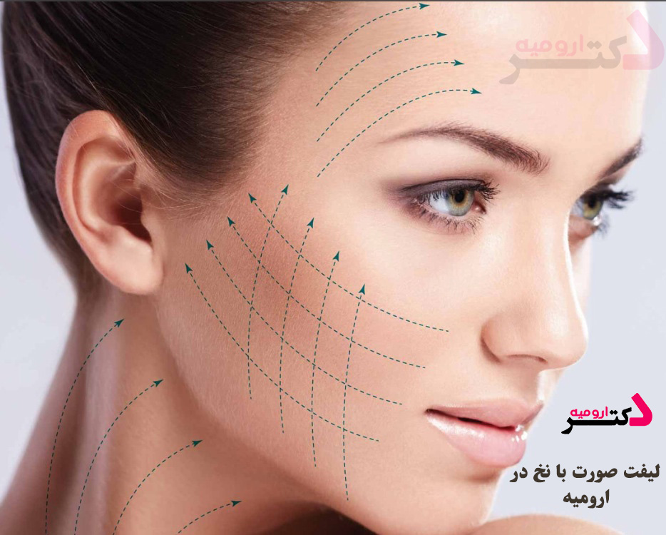 لیفت نخ در ارومیه