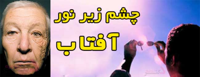 چشم-زیر-نور-آفتاب